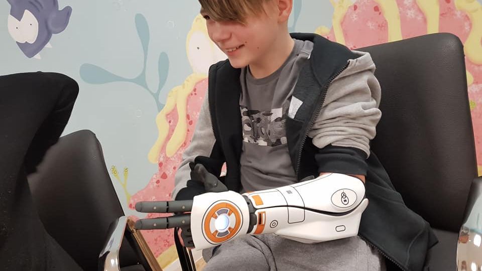 Bionická ruka z Hvězdných válek. Chlapci k ní pomohla sbírka